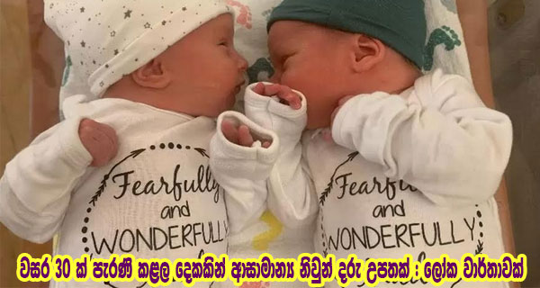 වසර 30 ක් පැරණි කළල දෙකකින් ආසාමාන්‍ය නිවුන් දරු උපතක් : ලෝක වාර්තාවක්