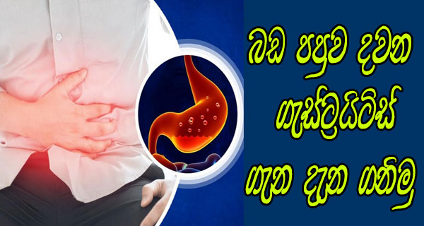 බඩ පපුව දවන ගැස්ට්‍රයිටිස් ගැන දැන ගනිමු