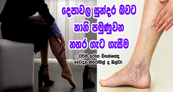 දෙපාවල සුන්දර බවට හානි පමුණුවන නහර ගැට ගැසීම