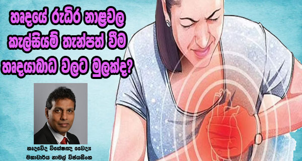 හෘදයේ රුධිර නාළවල කැල්සියම් තැන්පත් වීම හෘදයාබාධ වලට මුලක්ද? – හෘදවේද විශේෂඥ වෛද්‍ය මහාචාර්ය නාමල් විජයසිංහ