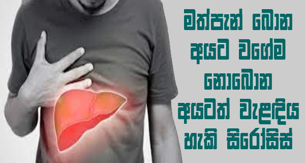 මත්පැන් බොන අයට වගේම නොබොන අයටත් වැළඳිය හැකි සිරෝසිස්