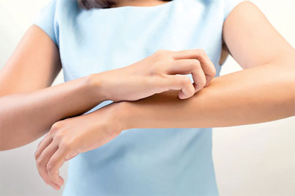 උණුසුම් කාලගුණ තත්ත්වය නිසා චර්ම රෝග