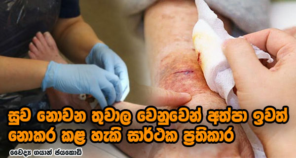 සුව නොවන තුවාල වෙනුවෙන් අත්පා ඉවත් නොකර කළ හැකි සාර්ථක ප්‍රතිකාර – වෛද්‍ය ගයාන් ජයකොඩි